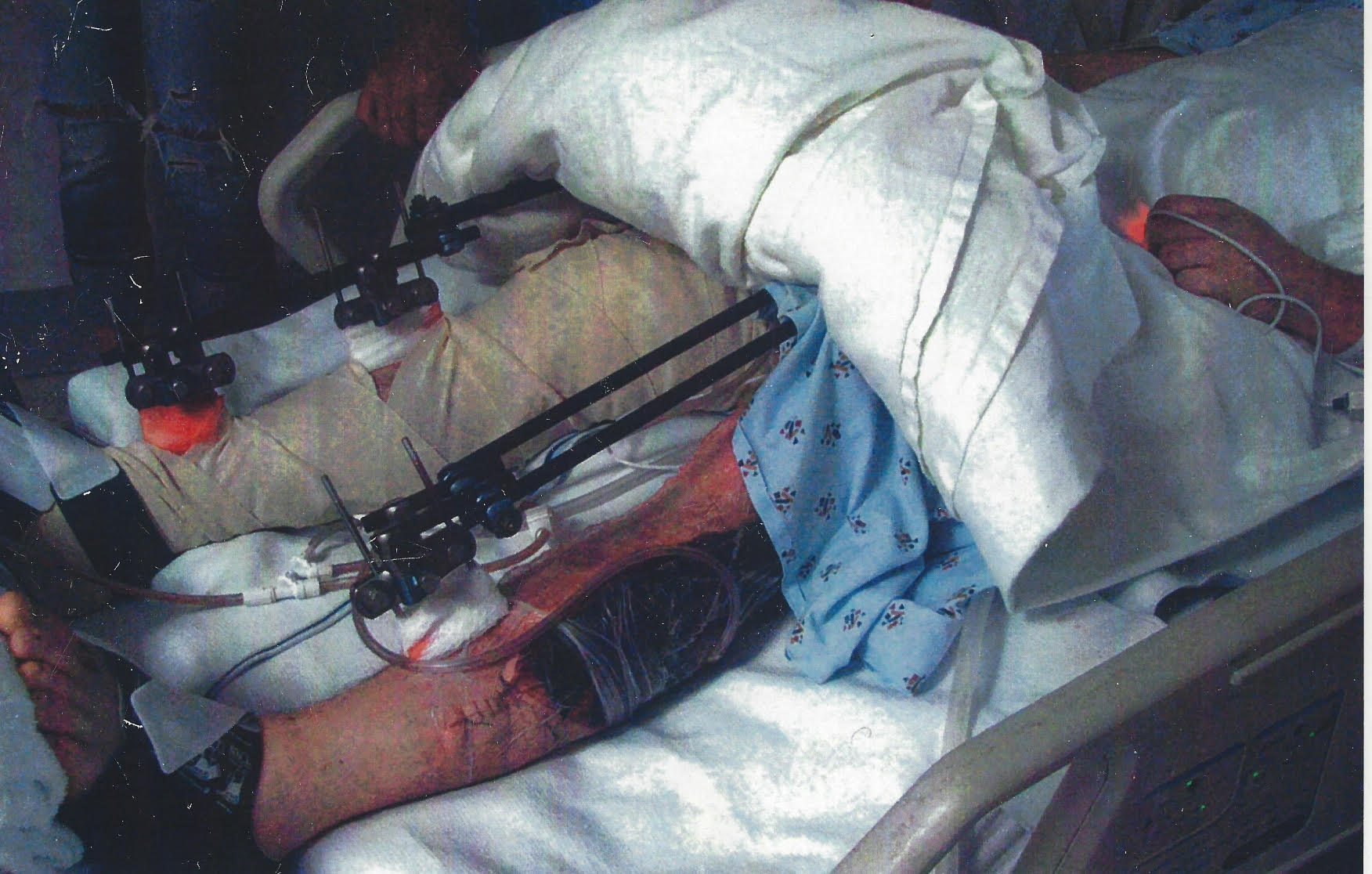 Shane recovering in the hospital after sustaining major injuries after his severe motorcycle accident.