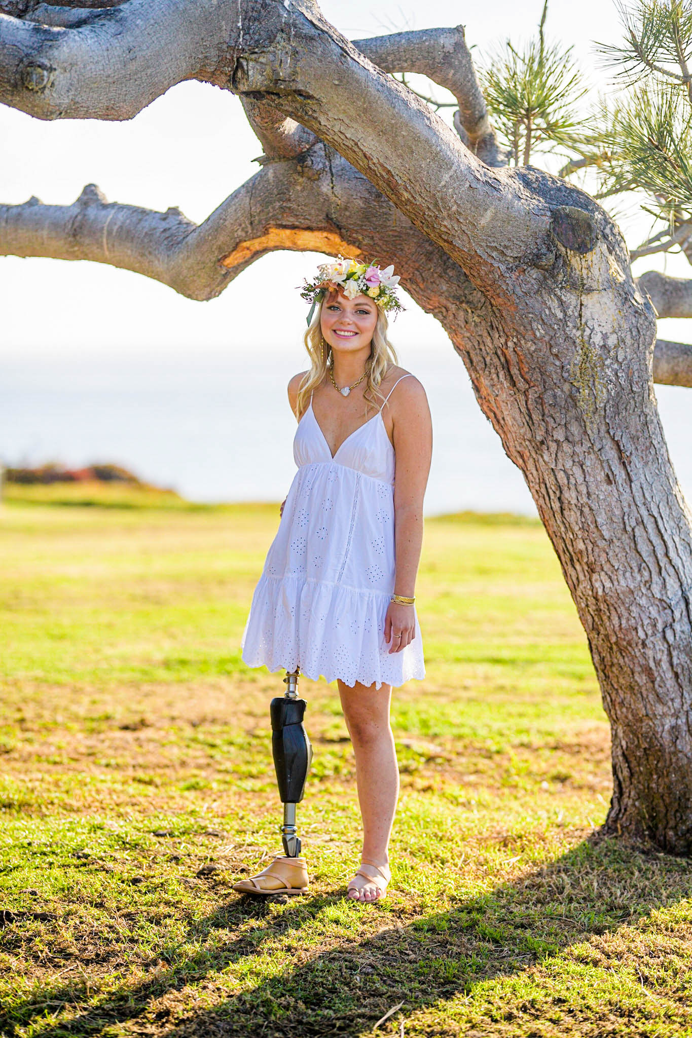 Nan, leg amputee, Beautifully Flawed Retreat attendee