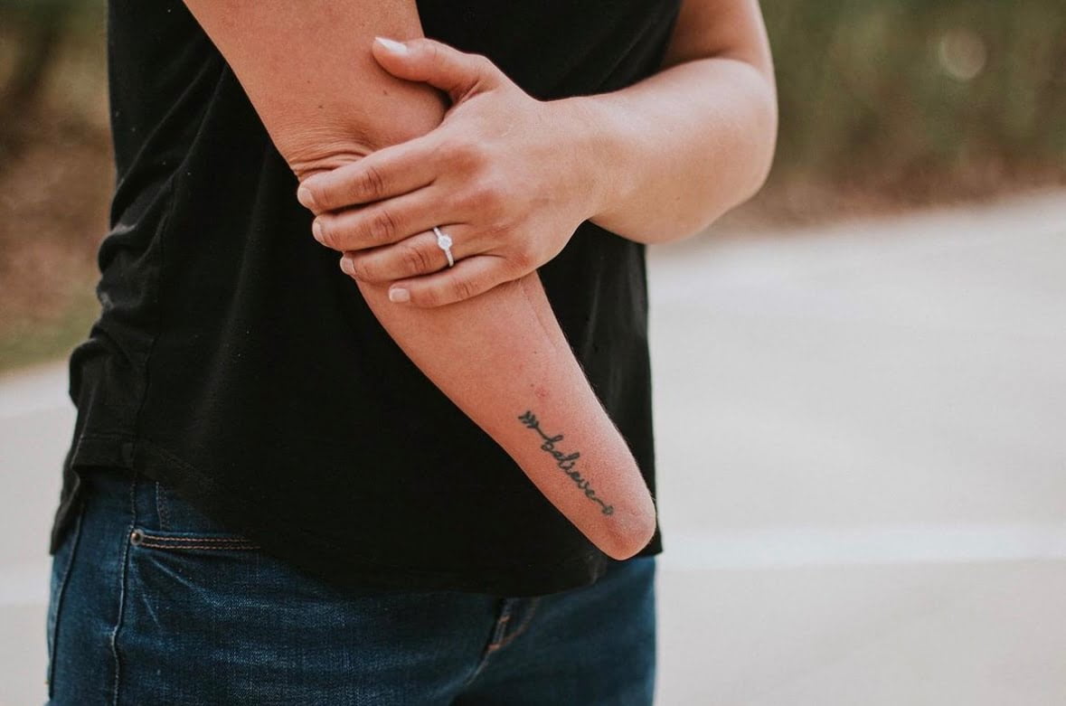 Carley's residual limb